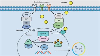 Clinical considerations of CDK4/6 inhibitors in HER2 positive breast cancer